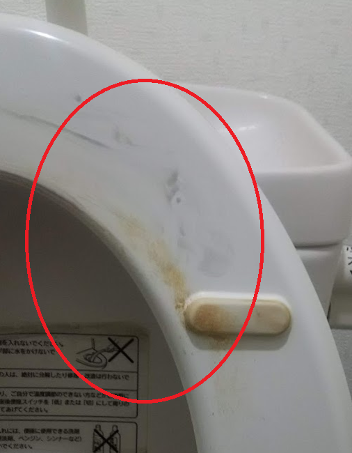 トイレの便座についたザラザラした尿石が10分で除去できました